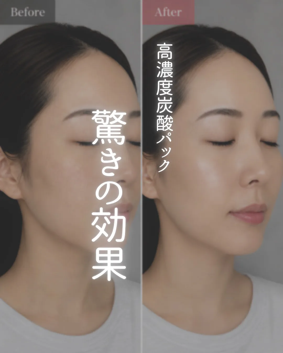 「年齢肌だから…」と諦めていませんか?