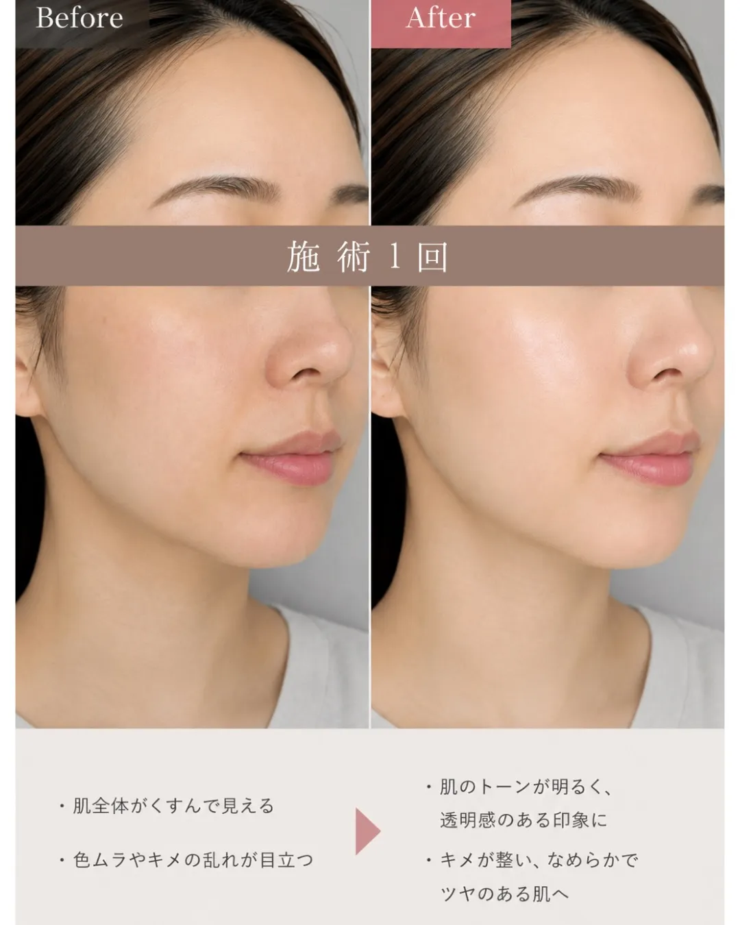 「年齢肌だから…」と諦めていませんか？