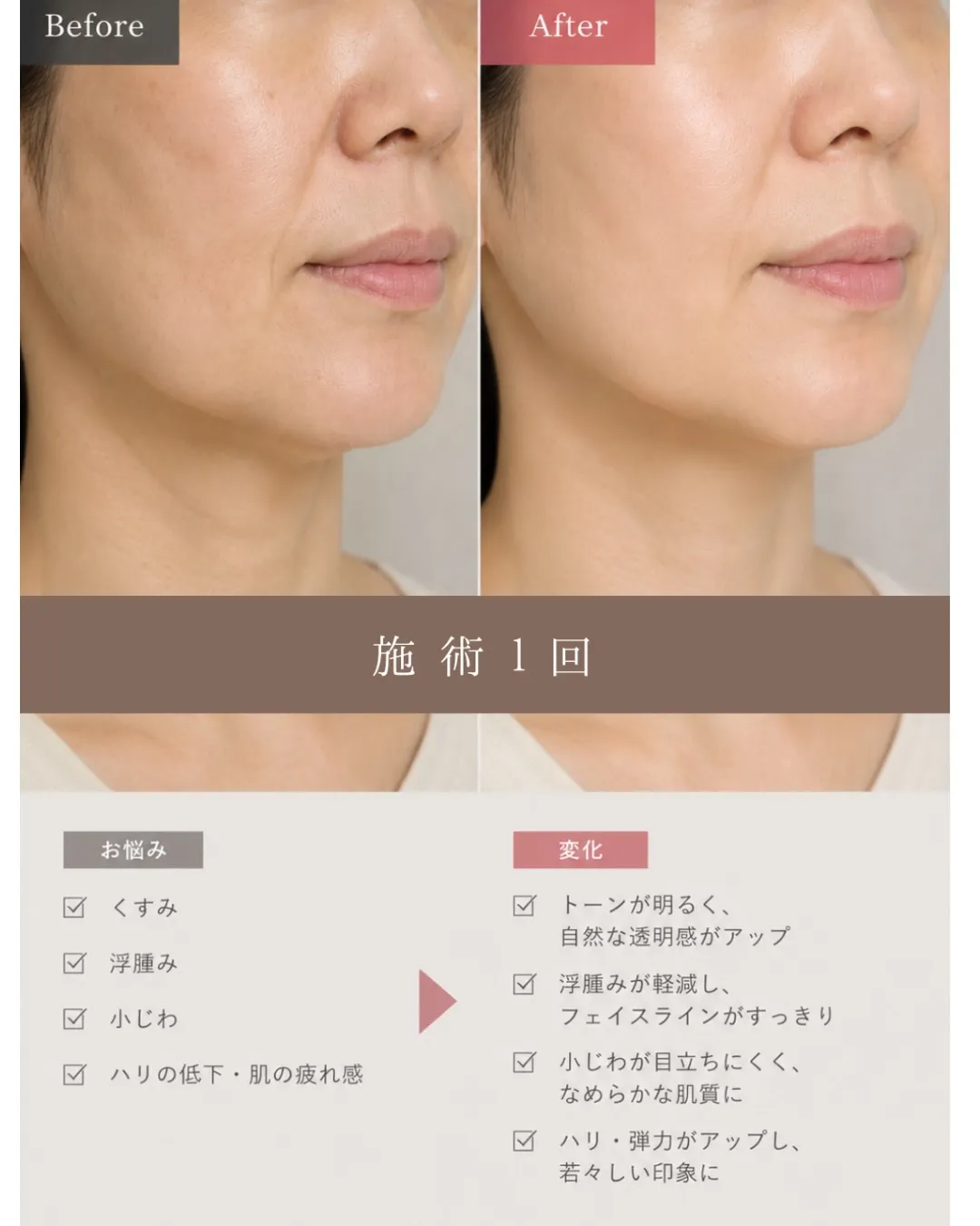 「年齢肌だから…」と諦めていませんか？
