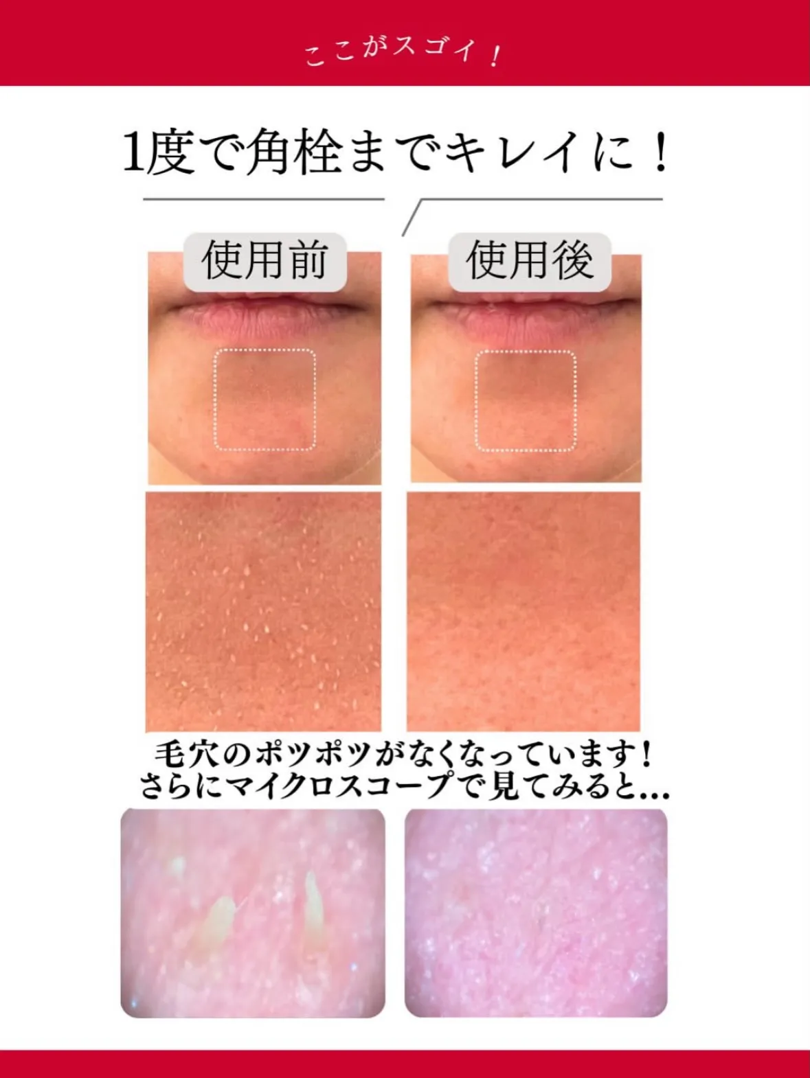 最近お肌の元気が無くなってきた方へ♪未来の肌は、毎日の「洗う...