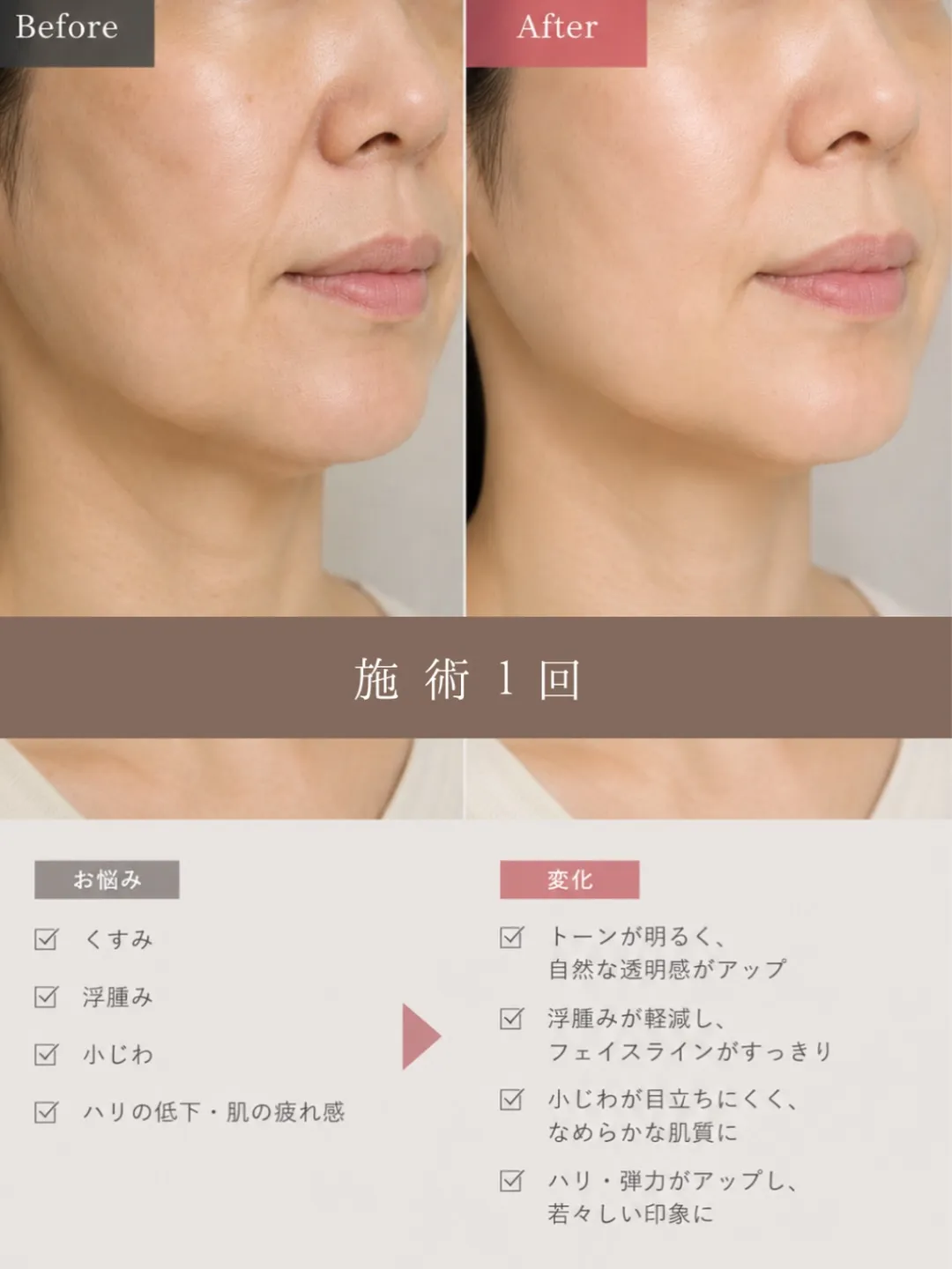 ⁡sango 高濃度炭酸パック