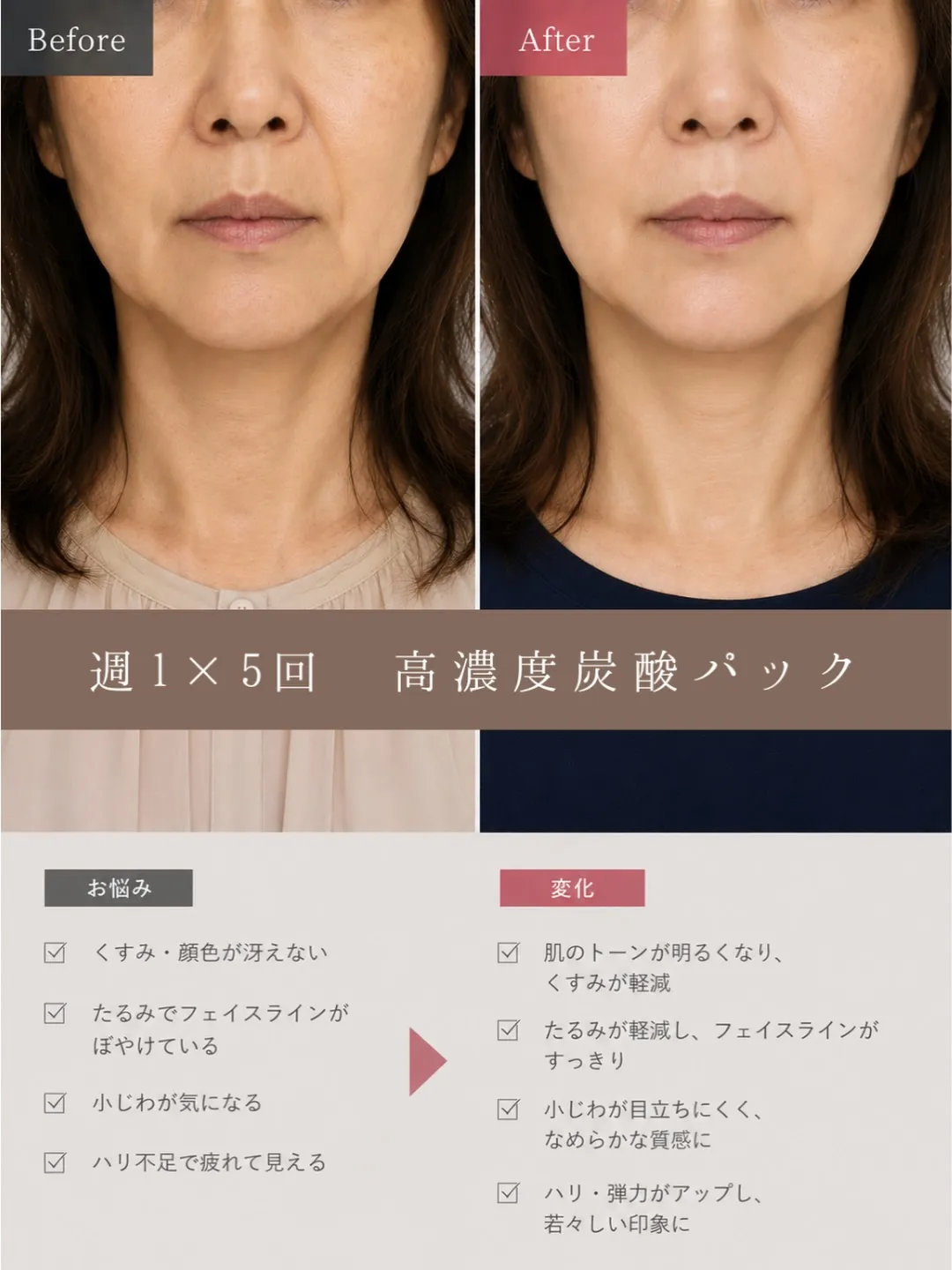 ⁡sango 高濃度炭酸パック