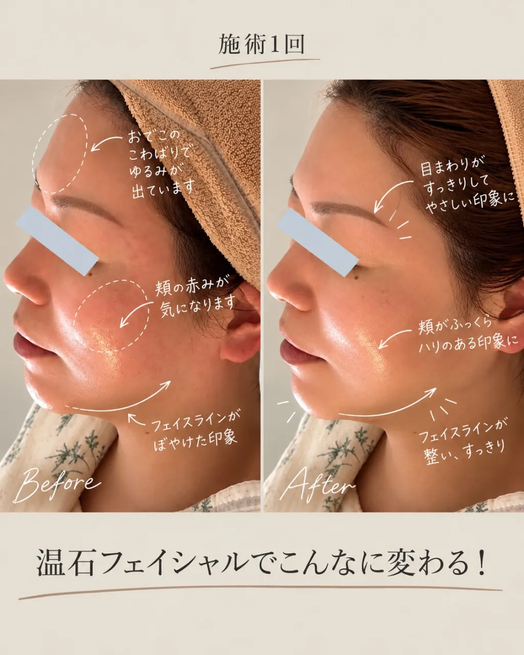 フェイシャルマッサージは、ただ撫でるだけじゃない。