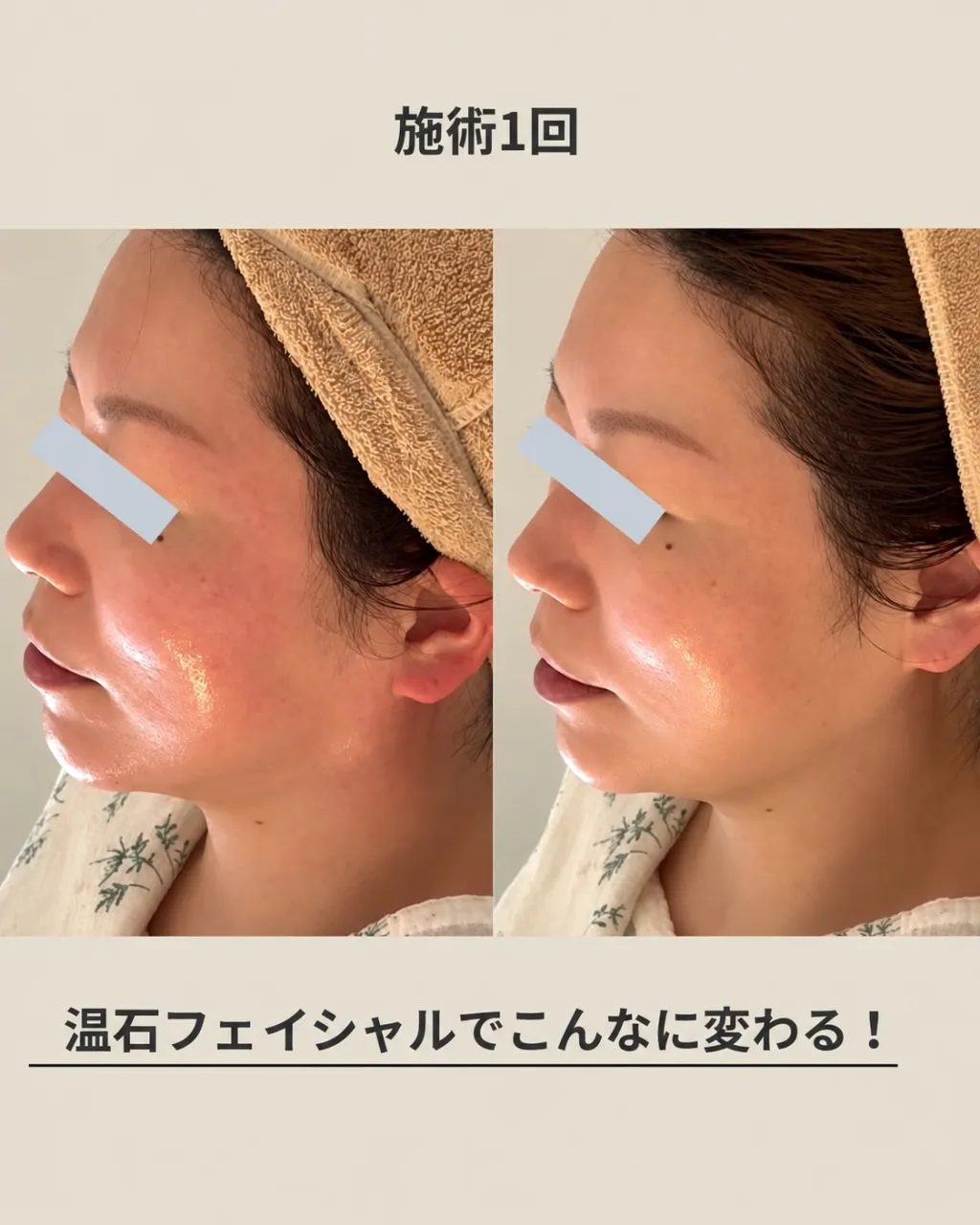 フェイシャルマッサージは、ただ撫でるだけじゃない。