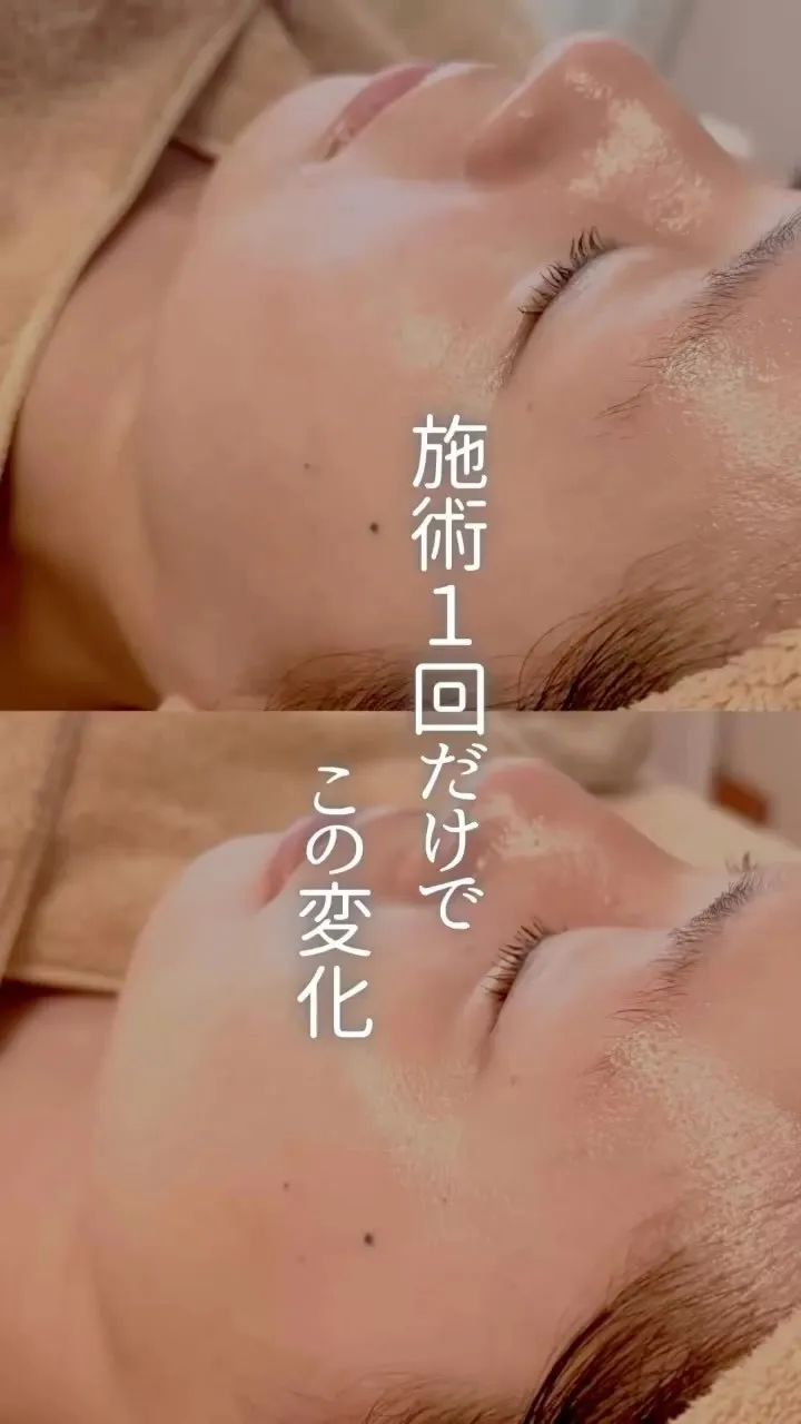 「顔が疲れてる…｣もたつき、くすみ、気になる東灘区でお探しの...